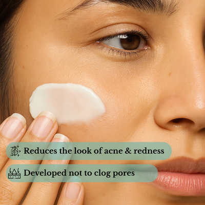 Lysa Acne