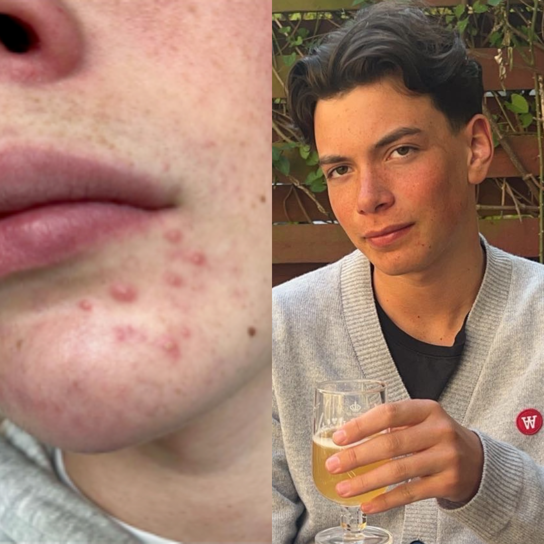 Before and after