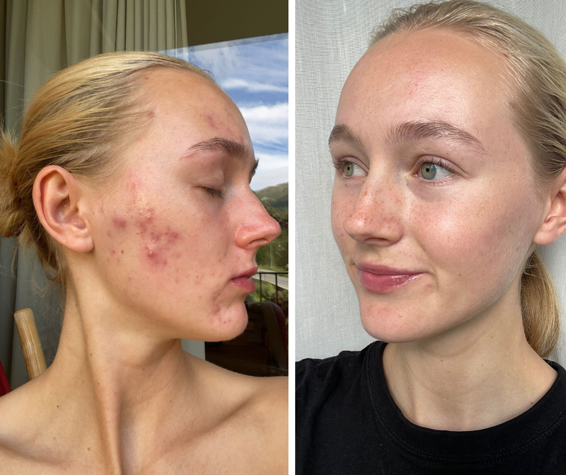 Results You Can See in 14 Days