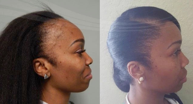 Keisha, 34