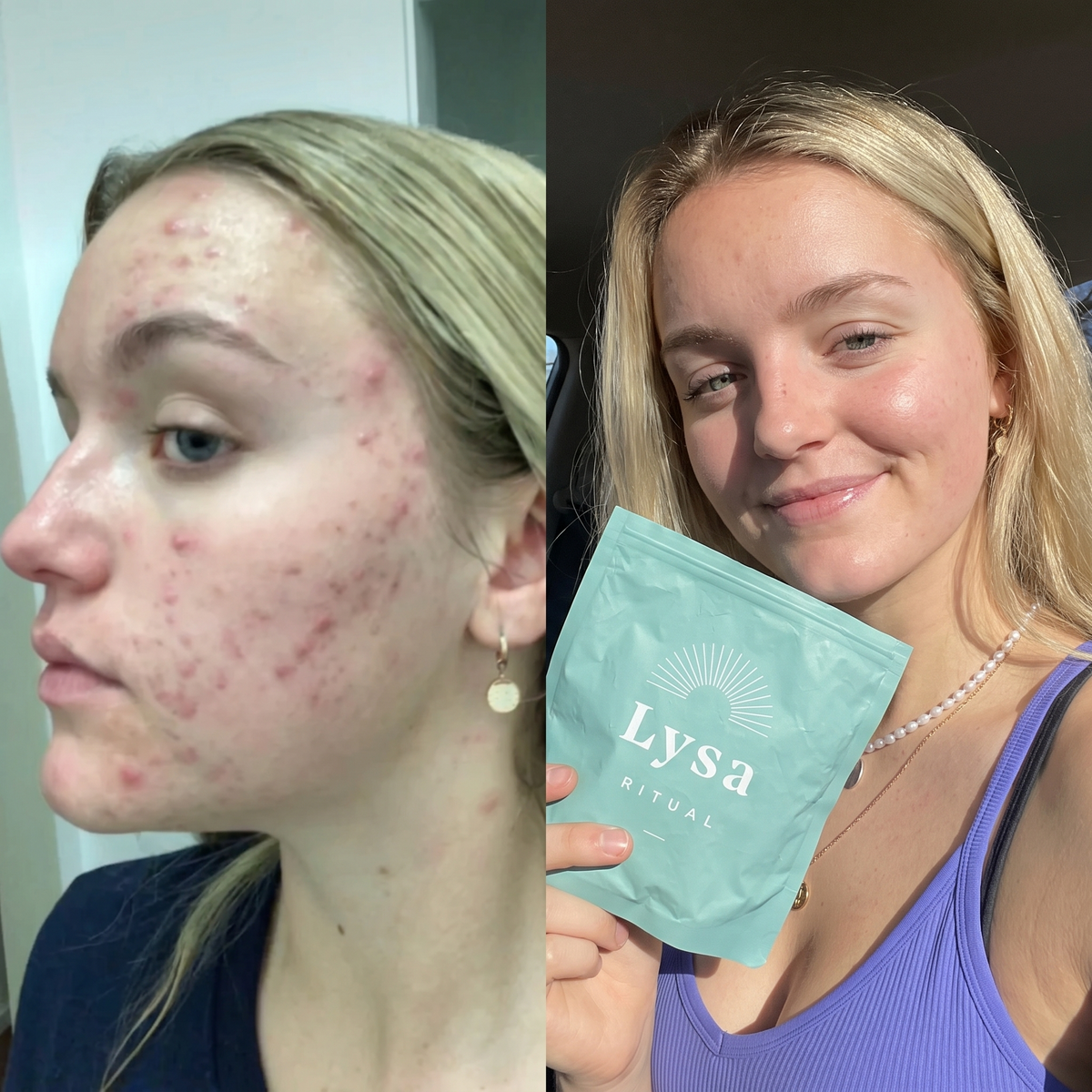 Before and after
